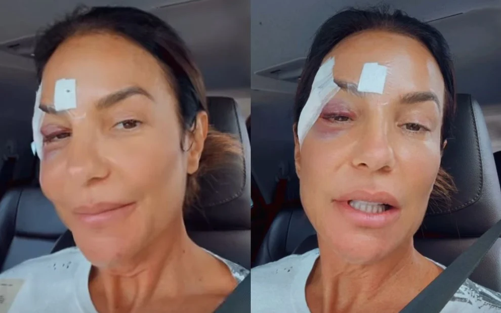 Ivete Sangalo recebe alta após mal-estar e tranquiliza fãs em Salvador