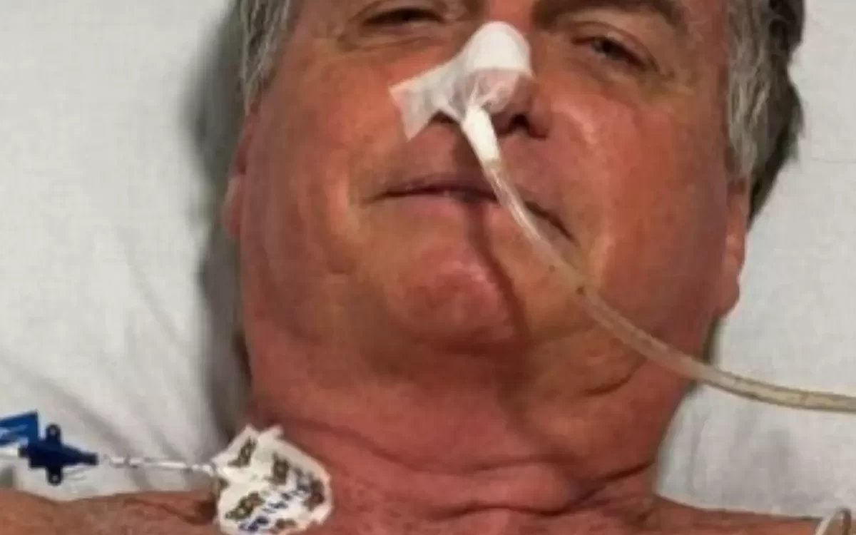 Bolsonaro enfrenta recuperação “delicada e prolongada” após cirurgia de 12 horas