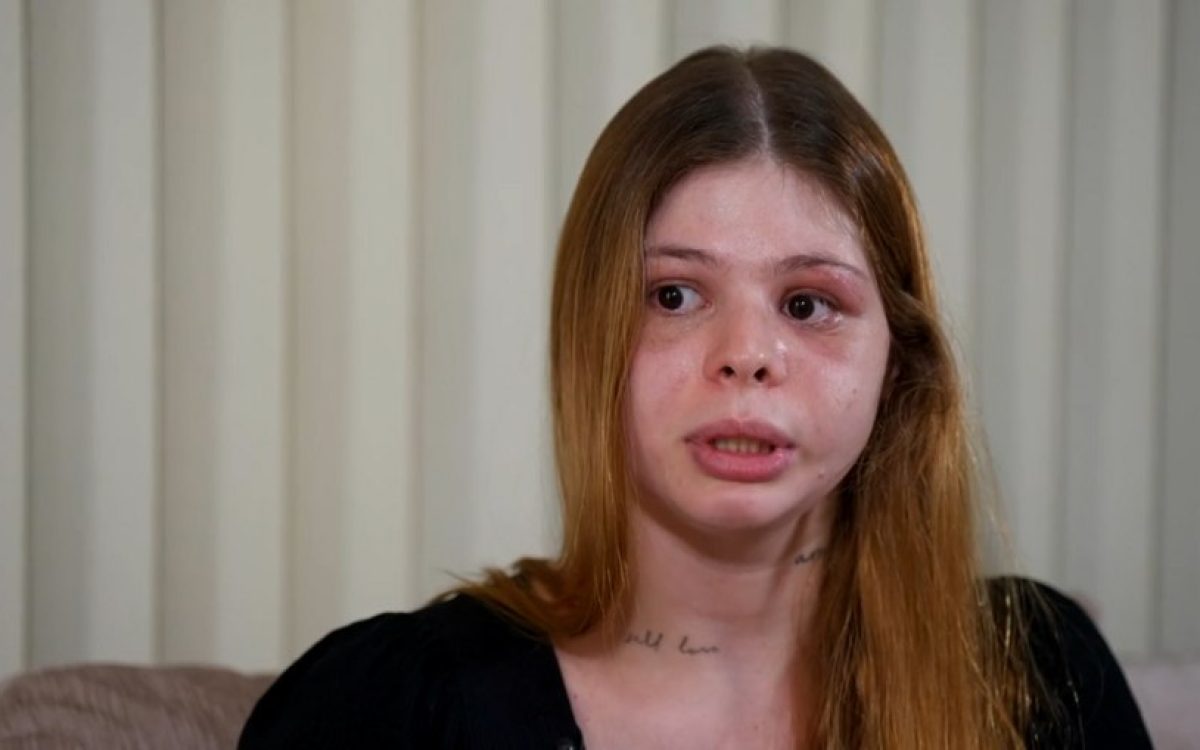 “Quase me mata no meu aniversário”, relata médica após agressão do namorado