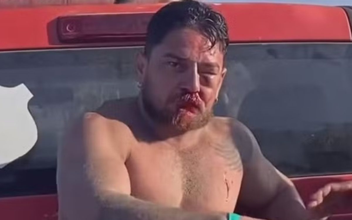 Casal de turistas é agredido em Porto de Galinhas após desacordo sobre cobrança de cadeiras