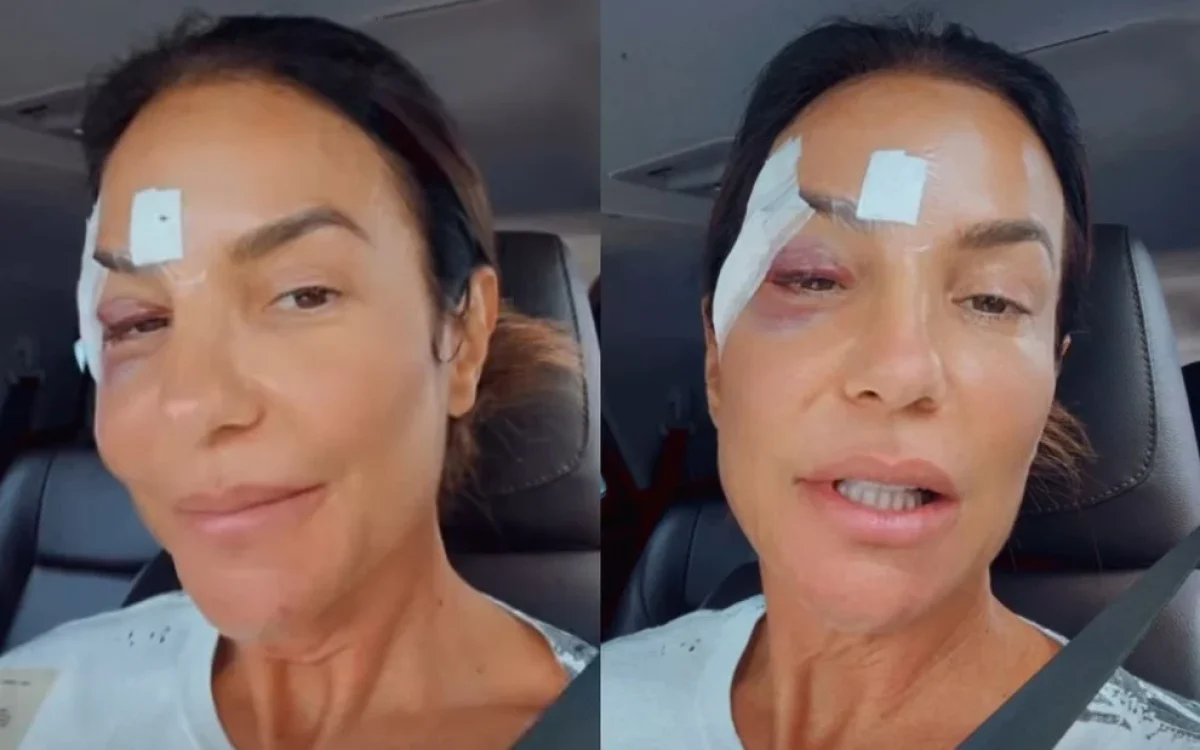 Ivete Sangalo recebe alta após mal-estar e tranquiliza fãs em Salvador